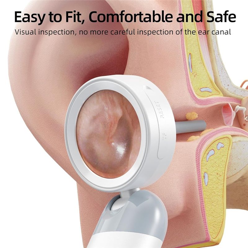 LXYB18B Wireless Ear Otoscope  - Webcam Hd 1080P 评论和价格