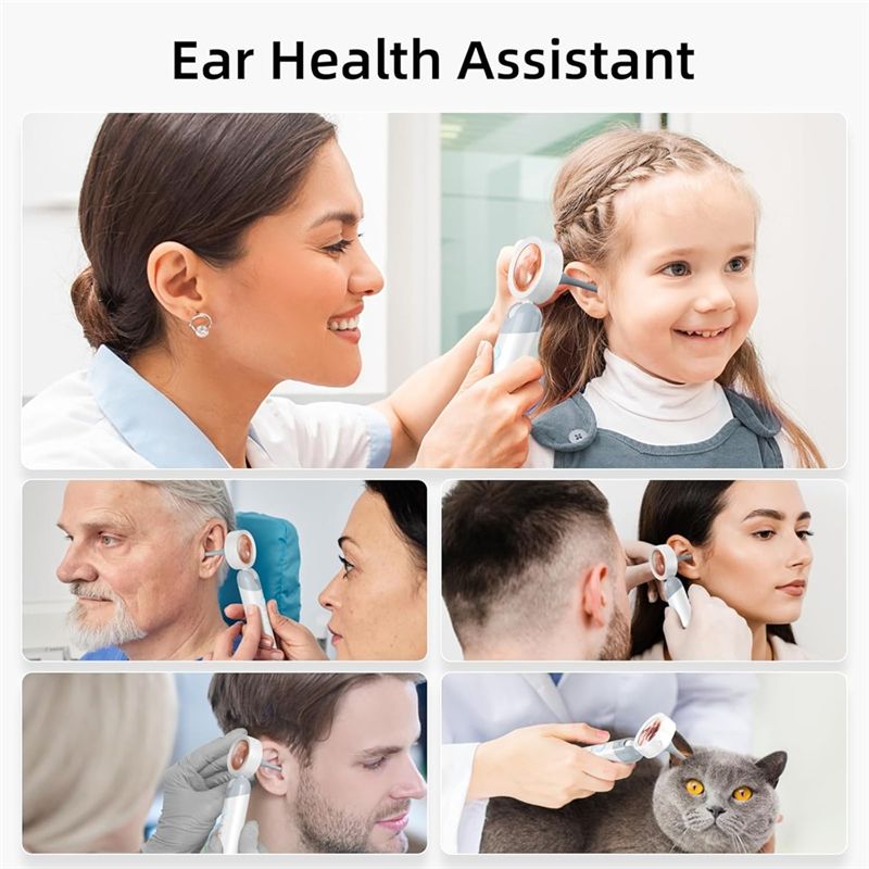 LXYB18B Wireless Ear Otoscope  - Webcam Hd 1080P 评论和价格